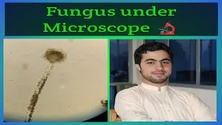 Fungus Under Microscope 🔬|E-learn with Technologist