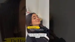 Barbie nose surgery in Iran (the capital of #rhinoplasty #تجميل_الأنف