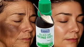 MINHA M&Atilde;E AOS 82 ANOS TIRA CODIGO DE BARRA\ RUGAS NA TESTA COM RICINO - usa 3 vezes