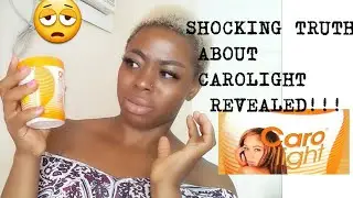 SHOCKING TRUTH ABOUT CAROLIGHT LIGHTENING BEAUTY CREAM REVEALED|SKIN BLEACHING CREAM| Must watch