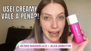 CREAMY | &Aacute;cido Mand&eacute;lico + Alfa Arbutin | Esfoliante Qu&iacute;mico