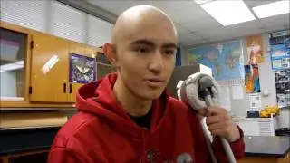 The Story Of 16 Year Old Alex Parra Who Lost His Leg To Bone Cancer