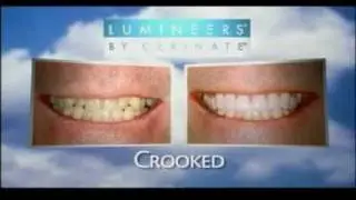 Lumineers By Cerinate - Dr. Mark E. Massaro, DDS - Tulsa, OK