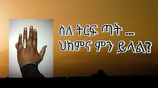 ስለ ትርፍ ጣት ምን ያህል ያውቃሉ?