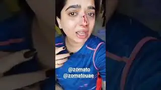 zomato delivery boy pinched a women | zomato