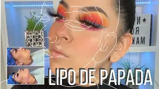 MI EXPERIENCIA CON LA LIPO DE PAPADA