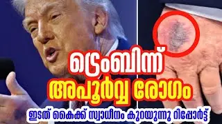 ട്രെംബിൻ്റെ ഇടത് കൈക്ക് സ്വാധീനം കുറയുന്നു റിപ്പോർട്ട് #hamdinspir