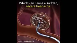This surgery prevent internal bleeding in the brain