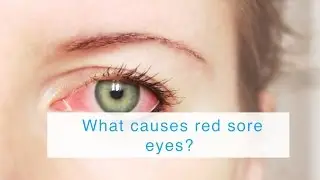 What causes red sore eyes?