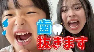 【緊急事態】妹の歯抜きます！！