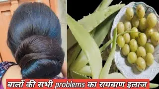 मेरे लम्बे घने बालों का राज़। Extremely long and strong hair । Hairfall and Dandruff करे ख़त्म 💯✍️