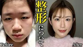 【総額公開】みやびの整形について、全てお話します。