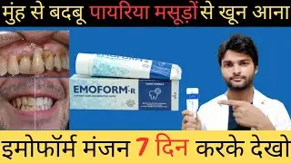 Emofarm R Toothpaste मुंह से बदबू आना,पायरिया, मसूड़ों में सूजन और खून आना Guru Teja