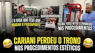 CARIANI PERDEU O TRONO NOS PROCEDIMENTOS EST&Eacute;TICOS