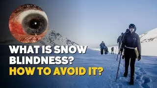 What is Snow Blindness? Symptoms, Treatment & Prevention| Trekking Tips | Indiahikes