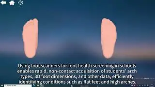 Foot Scanner Application in School Foot Screening &ndash; 3DOE