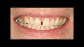 Seattle Cosmetic Dentist Lance Timmerman DMD