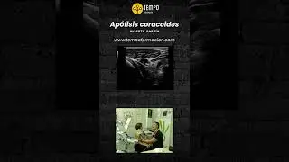 Apofisis coracoides y ecograf&iacute;a con D. Alberto Garc&iacute;a