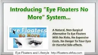 Floaters In Left Eye Icd 10