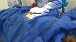 Sedaci&oacute;n para neurolisis