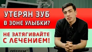 Как мы помогаем пациентам при потере переднего зуба, то есть зуба в зоне улыбки?