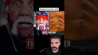 Hulk Hogan has lost HOW MUCH of his height?! #morbidfacts