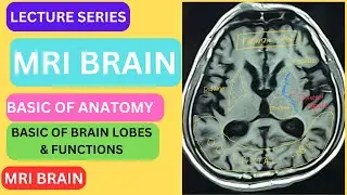 LECTURE SERIES - MRI BRAIN - NORMAL BRAIN STRUCTURES AND FUNCTIONS WITH ANATOMY
