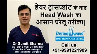 First Head Wash After Hair Transplant | Hair Wash after Hair Transplant |Head Wash After Transplant