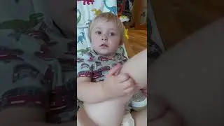 Myoclonic Seizure Confirmed via EEG in Child. Epilepsy Autism. Video For Educational Purposes 2