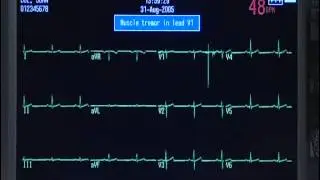 MAC 5500 Training Video (Part 2)