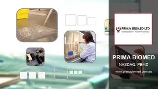 SECFilings.com Executive Interview | Prima Biomed (NASDAQ: PBMD)