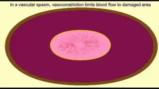 AP2 EXAM 1: VASCULAR SPASM