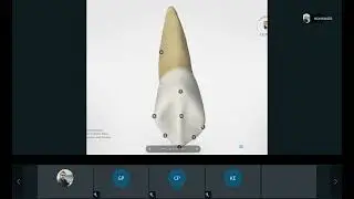1411 05 Teeth Morphology