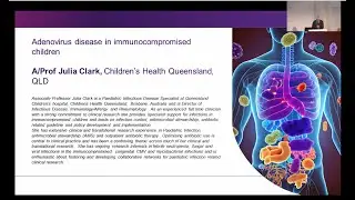 Adenovirus disease in immunocompromised children A/Prof Julia Clark