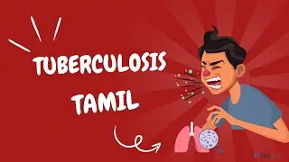 Tuberculosis (TB) in Tamil: Definition, Symptoms, Causes, Diagnosis, and Management