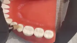 Polishing & Shaping a Premolar Composite for ADEX | Step-by-Step Tips!