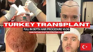 Turkey Hair Transplant - FUE Procedure Vlog at Hair of Istanbul - 4,400 Grafts #HairTransplant