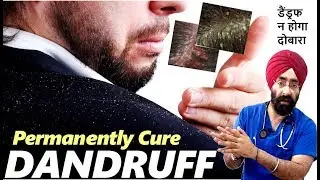 Permanently Cure DANDRUFF : समझो कारन और मेडिकल इलाज | Tips to Prevent Recurrence (HIN) Dr.Education