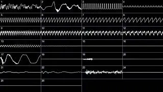 kleeder & Viravax - These Boxes Won't Unload Themselves! (oscilloscope)