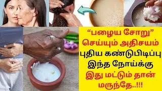 பழைய சோறு அதிசயம்!  Benefits of Palaya Soru in Tamil  Fermented Rice  Pazhaya Soru Health Tips