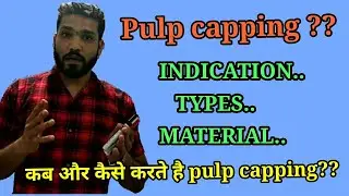 Pulp capping, types, material ,indications | How to do direct & indirect pulp capping?