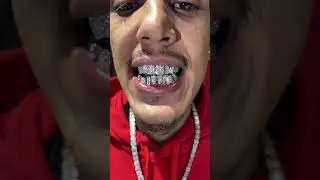 All VVS Diamond grill individuals to give it that permanent look tap in with us for the best grillz