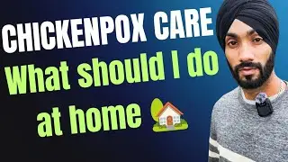 Chickenpox in Kids (No Panic) | Awareness Video | Real Experience In The Uk 🇬🇧 #multanifacts 