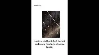 Common hair and scalp diseases and how to treat them:)