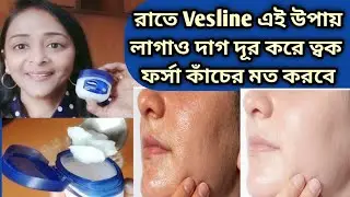 রাতে ঘুমনোর আগে Vesline এই উপায ত্বকে লাগালে দাগছোপ দূর হবে ফর্সা কাঁচের মত হবে/Vesline Night Cream