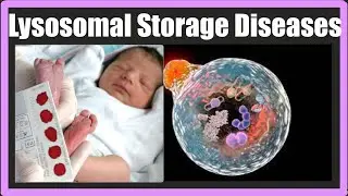 Lysosomal Storage Diseases Part 2 | Complete detail | Tay Sechs | Gyacheirs | Krabbes disease | Easy
