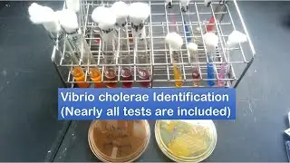 Vibrio cholerae identification / A to Z tests
