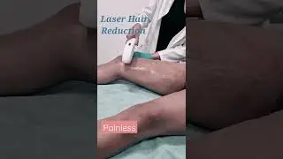 Painless Laser Hair Removal for unwanted hair on the body at Myra skin and hair solutions, Delhi