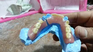 #Denture repair#Dentures