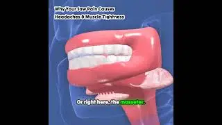 🔥 TMJ Inflammation &rarr; Headaches & Muscle Pain Explained 🧠💀